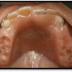 3.3c z spring appliance-min