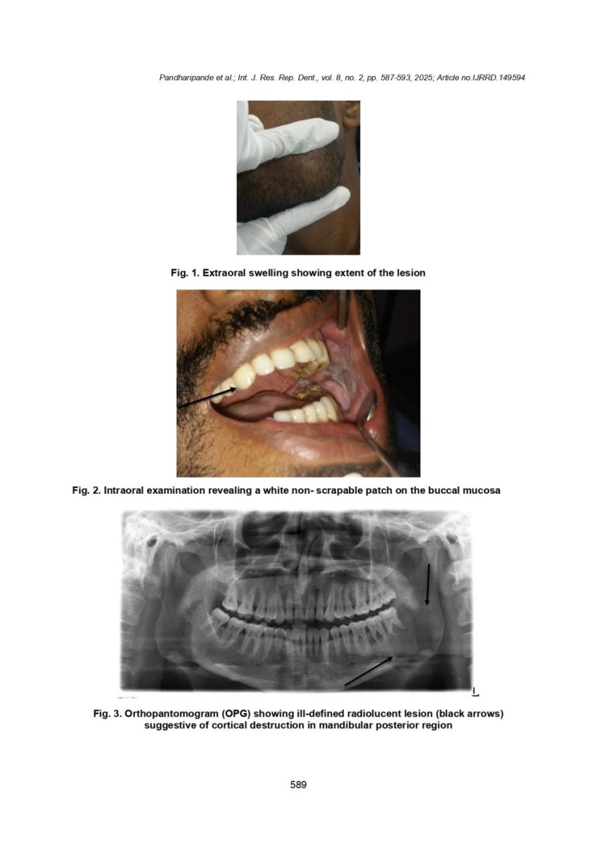 Rucha822025IJRRD149594_page-0003